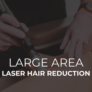 Laser Hair Reduction - Large Area