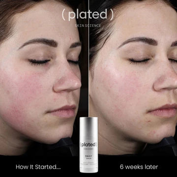 Plated Daily Serum. - Full Size    $258.00 USD