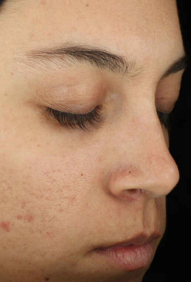 Complexion Clarifying Serum - ZO SkinHealth
