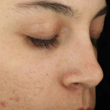 Complexion Clarifying Serum - ZO SkinHealth
