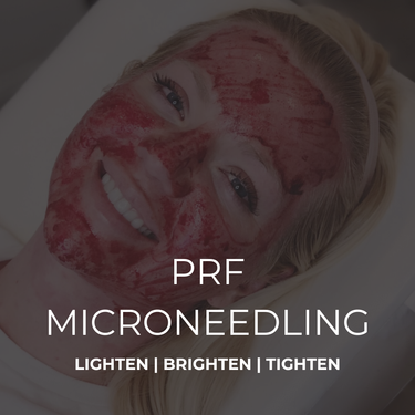PRF Microneedling
